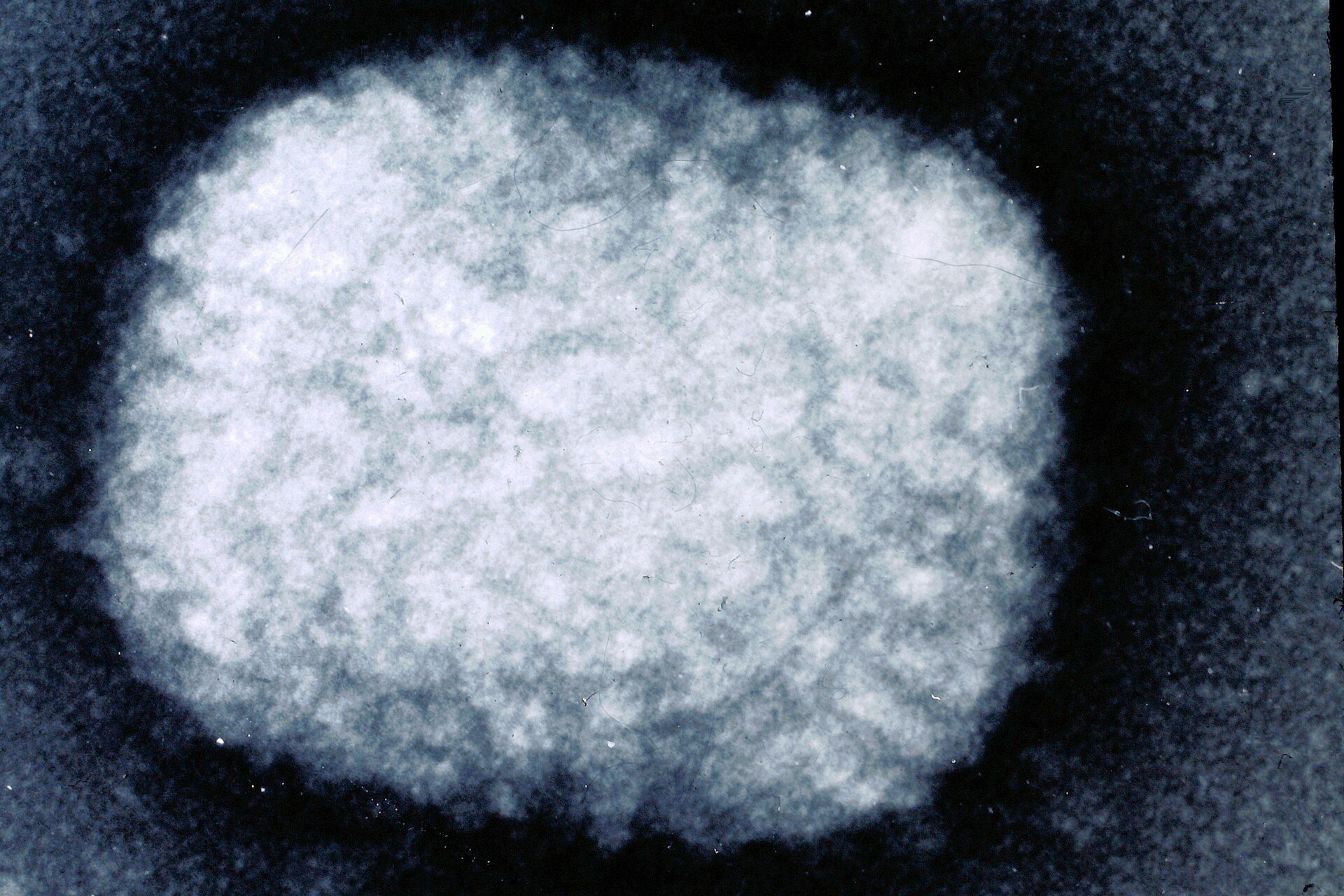 天花病毒(Variola virus)电子显微镜照片