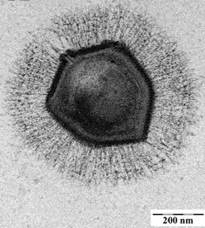 巨型病毒（Mimivirus）电镜照片